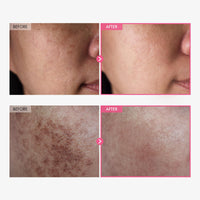 YiaknisUK TOSOWOONG Arbutin 7% + Tranexamic Acid 4% Face Cream 50ml - image 3